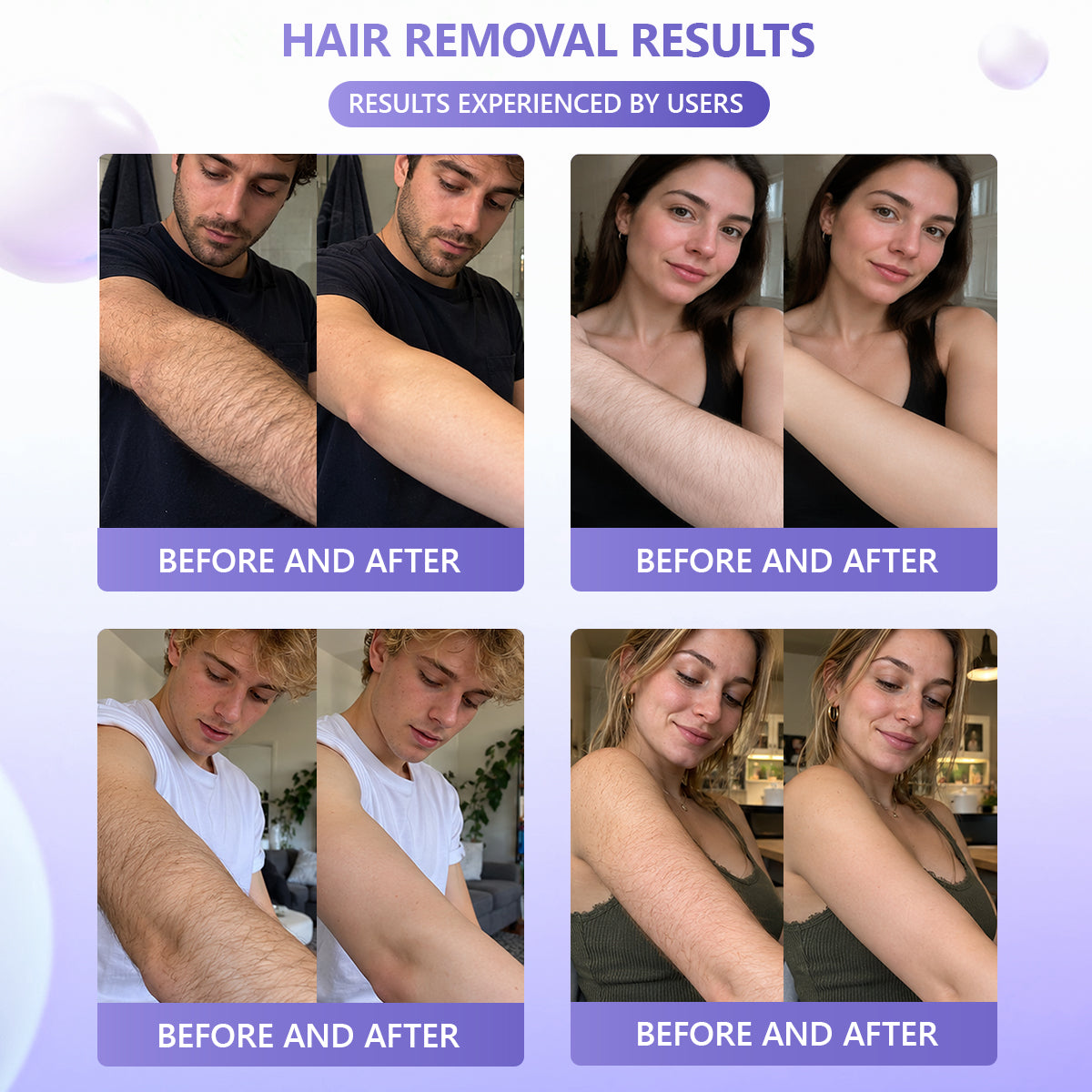 🔥🔥𝐕𝐢𝐭𝐚𝐥𝐢𝐬𝐲𝐬® Gentle Hair Removal Cream for Sensitive Skin — Hypoallergenic Formula, Fast-Acting Hair Removal, Suitable for Men and Women, Also Ideal for Hair Removal Around Intimate Areas
