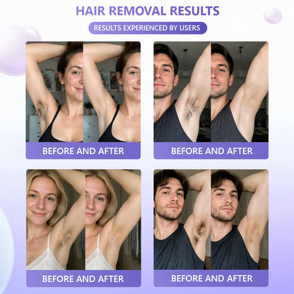 🔥🔥𝐕𝐢𝐭𝐚𝐥𝐢𝐬𝐲𝐬® Gentle Hair Removal Cream for Sensitive Skin — Hypoallergenic Formula, Fast-Acting Hair Removal, Suitable for Men and Women, Also Ideal for Hair Removal Around Intimate Areas