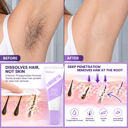 🔥🔥𝐕𝐢𝐭𝐚𝐥𝐢𝐬𝐲𝐬® Gentle Hair Removal Cream for Sensitive Skin — Hypoallergenic Formula, Fast-Acting Hair Removal, Suitable for Men and Women, Also Ideal for Hair Removal Around Intimate Areas