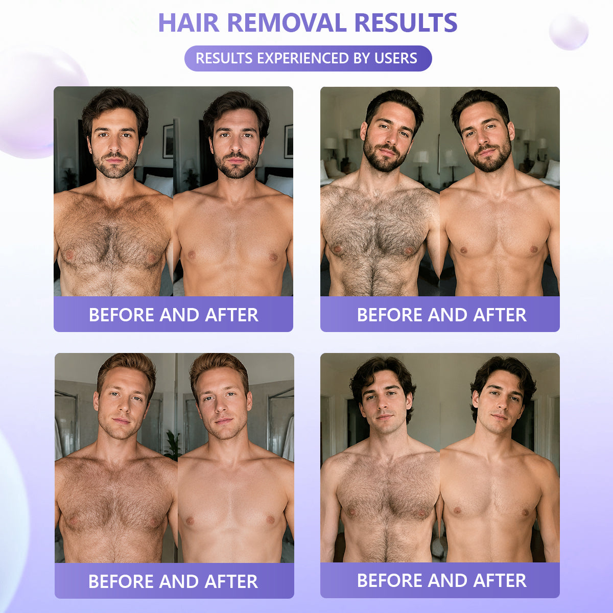 🔥🔥𝐕𝐢𝐭𝐚𝐥𝐢𝐬𝐲𝐬® Gentle Hair Removal Cream for Sensitive Skin — Hypoallergenic Formula, Fast-Acting Hair Removal, Suitable for Men and Women, Also Ideal for Hair Removal Around Intimate Areas