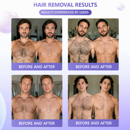 🔥🔥𝐕𝐢𝐭𝐚𝐥𝐢𝐬𝐲𝐬® Gentle Hair Removal Cream for Sensitive Skin — Hypoallergenic Formula, Fast-Acting Hair Removal, Suitable for Men and Women, Also Ideal for Hair Removal Around Intimate Areas