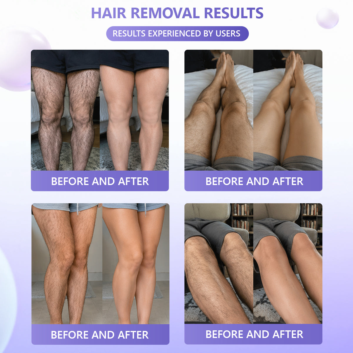 🔥🔥𝐕𝐢𝐭𝐚𝐥𝐢𝐬𝐲𝐬® Gentle Hair Removal Cream for Sensitive Skin — Hypoallergenic Formula, Fast-Acting Hair Removal, Suitable for Men and Women, Also Ideal for Hair Removal Around Intimate Areas