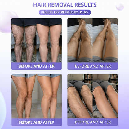 🔥🔥𝐕𝐢𝐭𝐚𝐥𝐢𝐬𝐲𝐬® Gentle Hair Removal Cream for Sensitive Skin — Hypoallergenic Formula, Fast-Acting Hair Removal, Suitable for Men and Women, Also Ideal for Hair Removal Around Intimate Areas